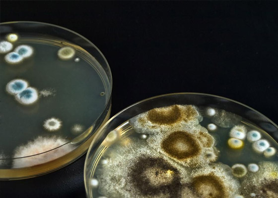 霉菌培養(yǎng)箱的溫度怎么設(shè)置