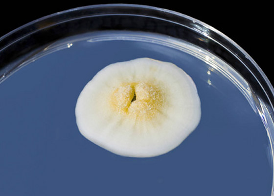 霉菌培養(yǎng)箱溫度設(shè)定和注意事項